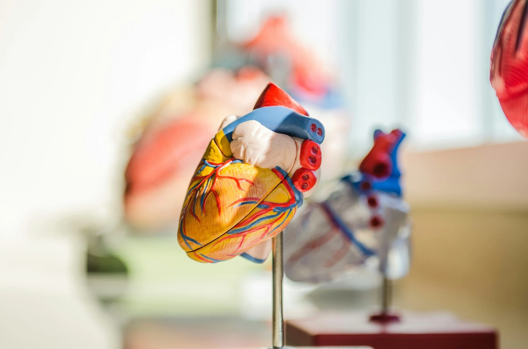 ¿Qué debe incluir un análisis de colesterol para evaluar el riesgo cardiovascular?